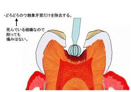 銀座歯科室キムラ 一般歯科