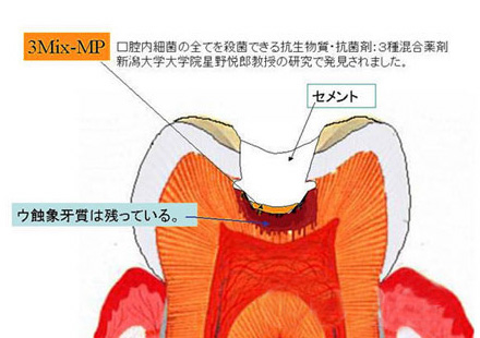 銀座歯科室キムラ 一般歯科