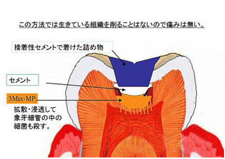 銀座歯科室キムラ 一般歯科